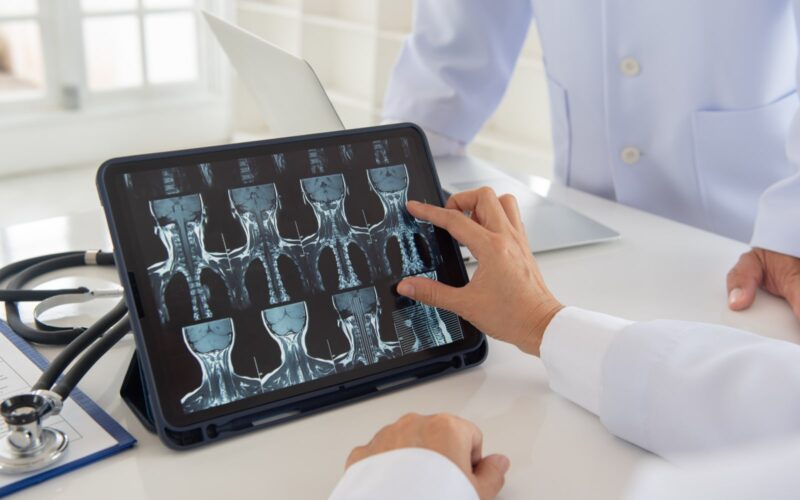 X-Rays For Bone Graft